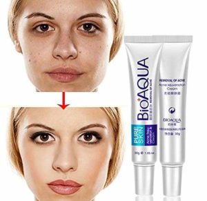 BIOAQUA Anti Acne Scar Mark Remover Removal Oil Control Shrink Pores Treatment Cream